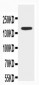 Anti-ABCB4 Antibody