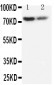 Anti-PMP70 Antibody