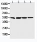 Anti-BAG5 Antibody