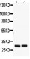 Anti-Bcl2A1 Antibody