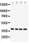 Anti-Caspase-12 Antibody