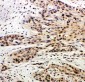 Anti-Caspase-14 Antibody