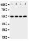 Anti-Cystatin A Antibody