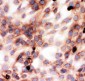 Anti-Gelsolin Antibody