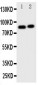 Anti-Gelsolin Antibody