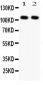 Anti-NFkB p105/p50 Antibody