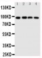 Anti-SIDT1 Antibody