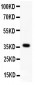 Anti-Wnt4 Antibody