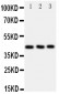 Anti-CCR9 Antibody