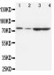 Anti-PCSK9 Antibody