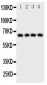 Anti-Parathyroid Hormone Receptor 1 Antibody