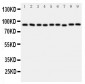 Anti-VCP Antibody