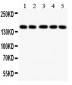 Anti-Collagen II Antibody