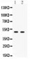 Anti-E2F3 Antibody