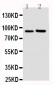 Anti-FGFR3 Antibody