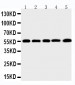 Anti-MMP-12 Antibody