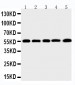 Anti-MMP-12 Antibody