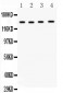 Anti-MMP-14 Antibody