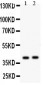 Anti-NDRG2 Antibody