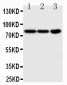 Anti-TrkA Antibody