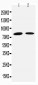 Anti-TGM2 Antibody