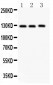 Anti-Fibulin 2 Antibody