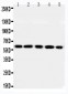 Anti-RGS14 Antibody