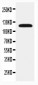 Anti-SLC12A1 Antibody