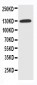 Anti-NKCC1 Antibody