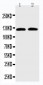 Anti-SLC12A6 Antibody