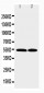 Anti-CCR3 Antibody