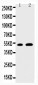 Anti-EGR2 Antibody