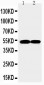 Anti-FLI1 Antibody