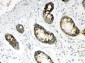 Anti-HYAL1 Antibody