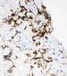 Anti-HYAL1 Antibody