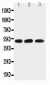 Anti-HYAL1 Antibody