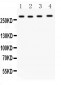 Anti-IGF2R Antibody