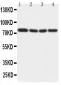 Anti-IRAK Antibody