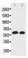 Anti-EAAT1 Antibody