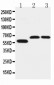 Anti-SLC1A4 Antibody