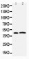 Anti-Leupaxin Antibody