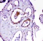 Anti-ACE Antibody