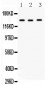 Anti-ACE Antibody