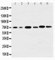 Anti-AKT3 Antibody