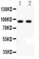 Anti-LI Cadherin Antibody