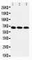 Anti-IRAKM Antibody