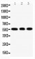 Anti-KLF4 Antibody