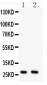 Anti-Olig1 Antibody