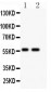 Anti-PIAS4 Antibody