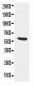 Anti-Alpha 1 Antichymotrypsin Antibody